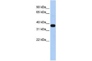 Western Blotting (WB) image for anti-Mitochondrial E3 Ubiquitin Protein Ligase 1 (MUL1) antibody (ABIN2458733) (MUL1 Antikörper)