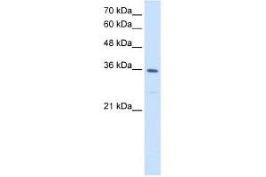 WB Suggested Anti-MTHFD2 Antibody Titration:  1. (MTHFD2 Antikörper  (N-Term))