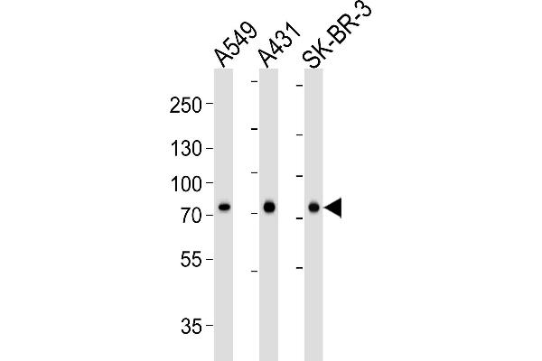 Calpain 2 Antikörper  (AA 1-400)