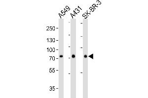 Western blot analysis of lysates from A549, A431, SK-BR-3 cell line (from left to right), using CN2 Antibody (ABIN6244177 and ABIN6577076). (Calpain 2 Antikörper  (AA 1-400))