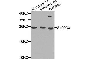 Western blot analysis of extract of various cells, using S100A3 antibody. (S100A3 Antikörper)
