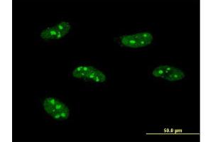 Immunofluorescence of monoclonal antibody to PWP1 on HeLa cell. (PWP1 Antikörper  (AA 1-501))