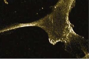 Immunofluorescent staining of Human Fibroblast cells with anti-E-Cadherin antibody.