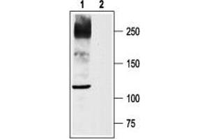 Western blot analysis of rat DRG lysates: - 1. (Nav1.8 Antikörper  (C-Term, Intracellular))