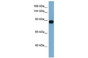 CASD1 antibody used at 1 ug/ml to detect target protein. (CASD1 Antikörper  (N-Term))