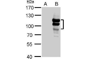 WB Image L3MBTL antibody detects L3MBTL protein by Western blot analysis. (L3MBTL1 Antikörper  (Center))