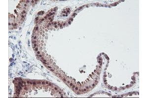 Immunohistochemical staining of paraffin-embedded Human breast tissue using anti-IRF6 mouse monoclonal antibody. (IRF6 Antikörper)