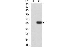 Western blot analysis using C3C mAb against HEK293 (1) and C3C (AA: 1521-1649)-hIgGFc transfected HEK293 (2) cell lysate. (Complement C3c Antikörper  (AA 1521-1649))