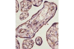 Immunohistochemistry (Paraffin-embedded Sections) (IHC (p)) image for anti-Transforming Growth Factor, beta Receptor III (TGFBR3) (AA 285-319) antibody (ABIN6243319)