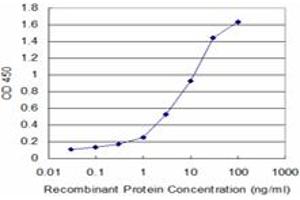 Detection limit for recombinant GST tagged LAD1 is approximately 0. (Ladinin 1 Antikörper  (AA 418-517))