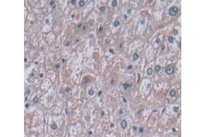 IHC-P analysis of Human Tissue, with DAB staining. (PIGR Antikörper  (AA 19-120))