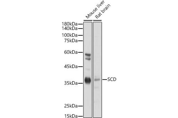 SCD Antikörper  (C-Term)