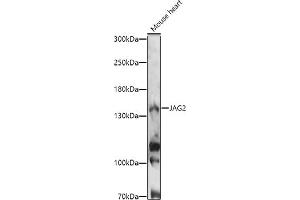 Western blot analysis of extracts of Mouse heart, using J antibody (ABIN7268035) at 1:1000 dilution.