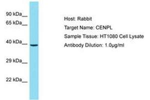 Image no. 1 for anti-Centromere Protein L (CENPL) (AA 121-170) antibody (ABIN6750825) (CENPL Antikörper  (AA 121-170))