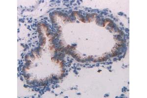 IHC-P analysis of lung tissue, with DAB staining. (Neuregulin 1 Antikörper  (AA 328-486))