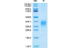 IL-22 Protein (AA 34-179) (His tag)