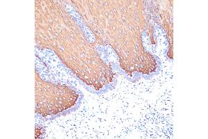 Immunohistochemistry of paraffin-embedded human esophageal using Cytokeratin 6 (KRT6) (KRT6) Rabbit mAb (ABIN7268104) at dilution of 1:100 (40x lens). (Keratin 6C Antikörper)