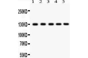 Western Blotting (WB) image for anti-Death-Domain Associated Protein (DAXX) (AA 56-345) antibody (ABIN3043822) (DAXX Antikörper  (AA 56-345))