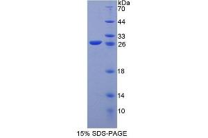 SDS-PAGE (SDS) image for Kell Blood Group, Metallo-Endopeptidase (KEL) (AA 128-332) protein (His tag) (ABIN6238779) (KEL Protein (AA 128-332) (His tag))