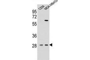 Western blot analysis in CEM,MDA-MB453 cell line lysates (35ug/lane) using Interleukin-12 beta/IL12B  Antibody (C-term). (IL12B Antikörper  (C-Term))