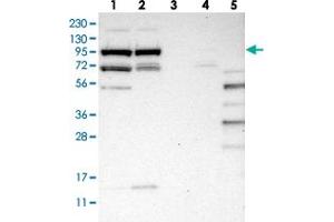 Western blot analysis of Lane 1: RT-4, Lane 2: U-251 MG, Lane 3: Human Plasma, Lane 4: Liver, Lane 5: Tonsil with SLFN5 polyclonal antibody  at 1:250-1:500 dilution. (SLFN5 Antikörper)