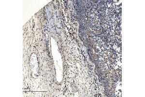 IHC analysis of Collagen VII/COL7A1 using anti-Collagen VII/COL7A1 antibody (ABIN7601052).