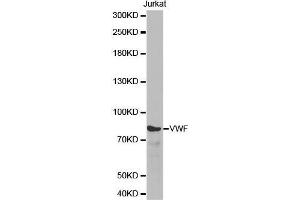 Western blot analysis of extracts of Jurkat cell line, using VWF antibody. (VWF Antikörper  (AA 50-150))