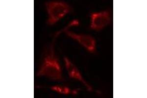 ABIN6275505 staining HuvEc cells by IF/ICC. (RIMKLA Antikörper  (Internal Region))