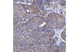 IHC analysis of TTC7B using anti-TTC7B antibody (ABIN7601050). (TTC7B Antikörper  (AA 275-730))