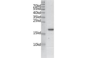 Recombinant BPTF / FALZ (2791-2911) protein gel.