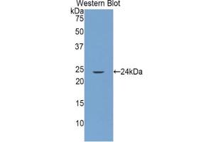 Western blot analysis of the recombinant protein. (GRIP1 Antikörper  (AA 79-268))