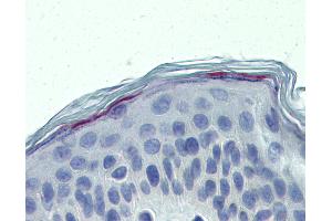 Anti-ERCC8 antibody IHC of human skin. (ERCC8 Antikörper  (AA 106-300))