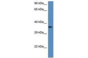 Image no. 1 for anti-C1q and Tumor Necrosis Factor Related Protein 2 (C1QTNF2) (AA 134-183) antibody (ABIN6747235) (C1QTNF2 Antikörper  (AA 134-183))