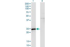 Western Blot analysis of SPA17 expression in transfected 293T cell line by SPA17 monoclonal antibody (M03), clone 3B6. (SPA17 Antikörper  (AA 51-149))