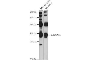 Western blot analysis of extracts of various cell lines, using SLC25 antibody (ABIN7270427) at 1:1000 dilution. (SLC25A31 Antikörper  (AA 100-200))