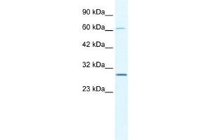 WB Suggested Anti-PAntibody   Titration: 2. (PARP11 Antikörper  (N-Term))