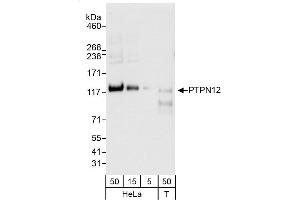 Western Blotting (WB) image for anti-Protein Tyrosine Phosphatase G1 (PTPN12) (AA 375-425) antibody (ABIN7451987)