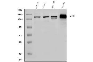 Western blot analysis of NCAM1 using anti-NCAM1 antibody (ABIN7602512). (CD56 Antikörper  (AA 80-328))