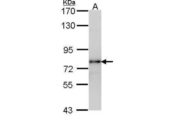 LHCGR Antikörper  (C-Term)