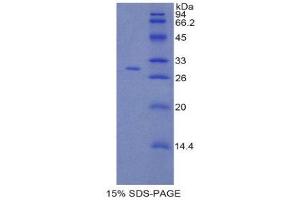 SDS-PAGE (SDS) image for Coagulation Factor V (F5) (AA 1979-2217) protein (His tag) (ABIN2120830) (Coagulation Factor V Protein (F5) (AA 1979-2217) (His tag))