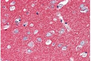 Human Brain, Cortex (formalin-fixed, paraffin-embedded) stained with SNAP25 antibody ABIN337119 at 2. (SNAP25 Antikörper  (AA 193-206))