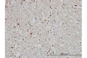 Image no. 1 for anti-DnaJ (Hsp40) Homolog, Subfamily B, Member 2 (DNAJB2) (AA 216-325) antibody (ABIN598751) (DNAJB2 Antikörper  (AA 216-325))