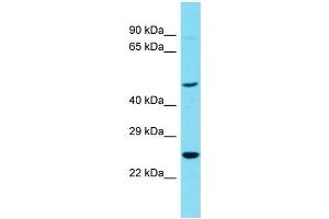 Host: Rabbit Target Name: RTN4RL1 Sample Type: OVCAR-3 Whole Cell lysates Antibody Dilution: 1. (RTN4RL1 Antikörper  (C-Term))