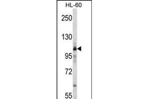 Western blot analysis of RS Antibody (C-term) (ABIN392313 and ABIN2841964) in HL-60 cell line lysates (35 μg/lane). (Mars (MARS) (AA 872-899), (C-Term) Antikörper)