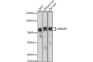 Western blot analysis of extracts of various cell lines, using IFNGR1 antibody (ABIN6127566, ABIN6142197, ABIN6142198 and ABIN6221420) at 1:1000 dilution. (IFNGR1 Antikörper  (AA 270-489))