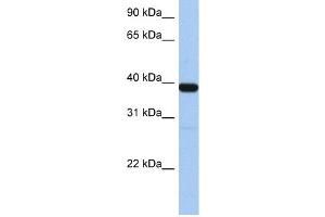 WB Suggested Anti-ZNF781 Antibody Titration:  0. (ZNF781 Antikörper  (N-Term))