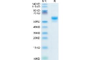 Human CD300LF on Tris-Bis PAGE under reduced condition. (IREM1 Protein (AA 20-156) (Fc Tag))