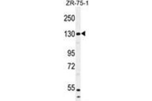 WWC1 Antibody (N-term) western blot analysis in ZR-75-1 cell line lysates (35 µg/lane). (WWC1 Antikörper  (N-Term))