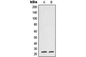 Western blot analysis of TCTP expression in DU145 (A), CCRFCEM (B) whole cell lysates.