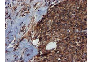 Immunohistochemistry (IHC) image for anti-Complement Component 1, S Subcomponent (C1S) antibody (ABIN1497565) (C1S Antikörper)